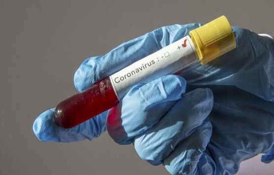 Koronavirüse karşı hangi ülke, ne tür önlemler aldı?