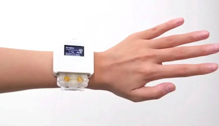 Bu saat bir canlı gibi yaşıyor! İlgisiz kalınca ölüyor