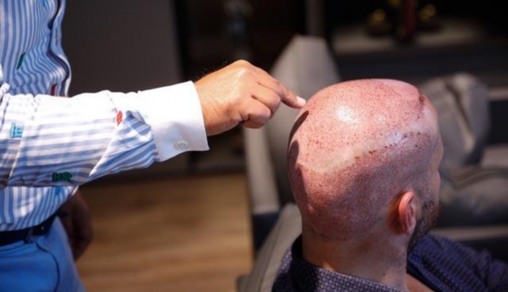 TÜRSAB Başkanı: ‘Bu yıl saç ektirmek için gelenlerde yüzde 20 artış olacak’