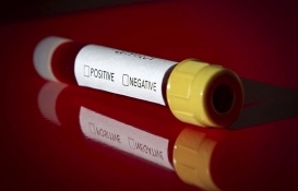 24 ilde Covid-19 Takip Merkezi açılacak!